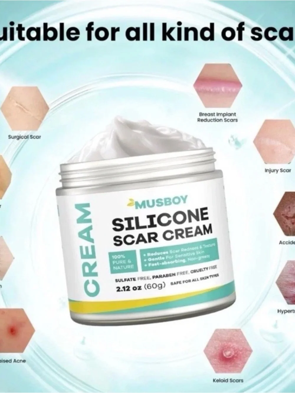 Silicone Scar Cream, Advanced Scar Cream, Stretch Marks, Surgical Scars, New